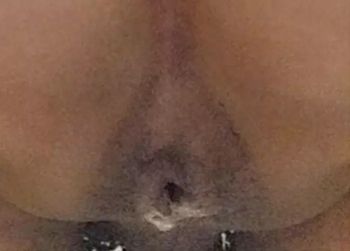 It was dripping daddy...