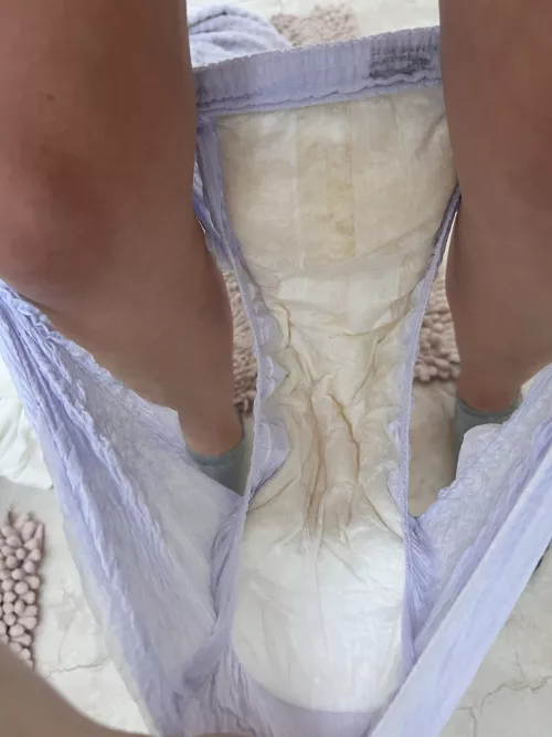 Update: accidents do happen