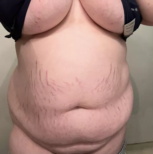 Anyone like stretch marks???