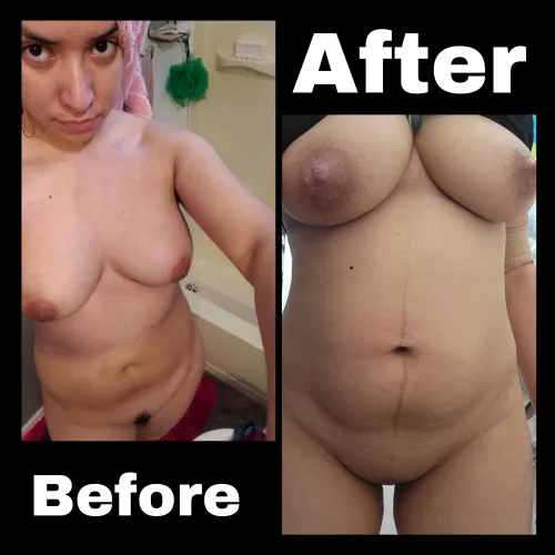 Before or after what do you chose