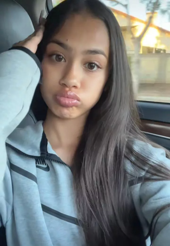 Big lips