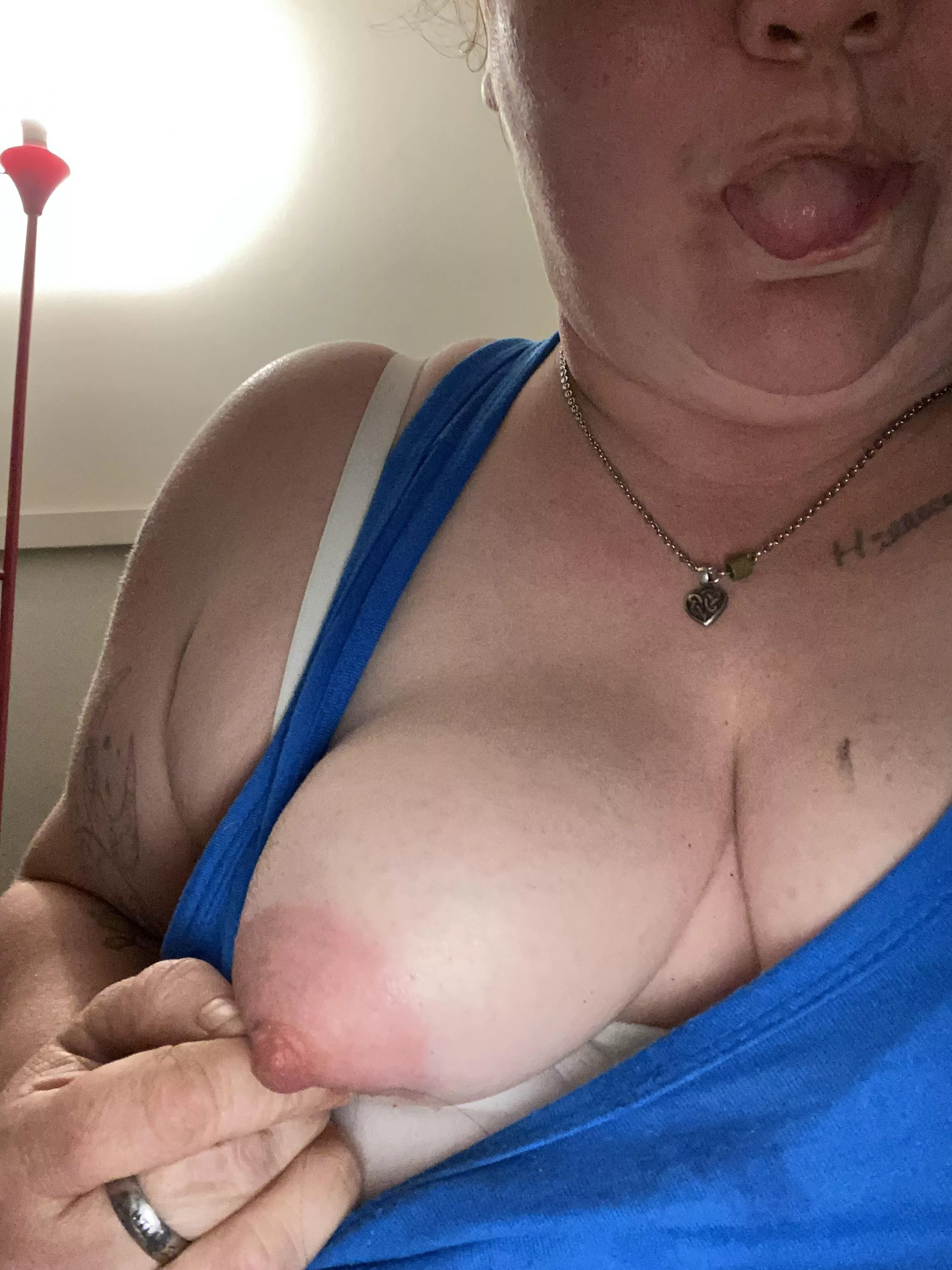 Broken ankle :( not going to stop my party tit being out ;)