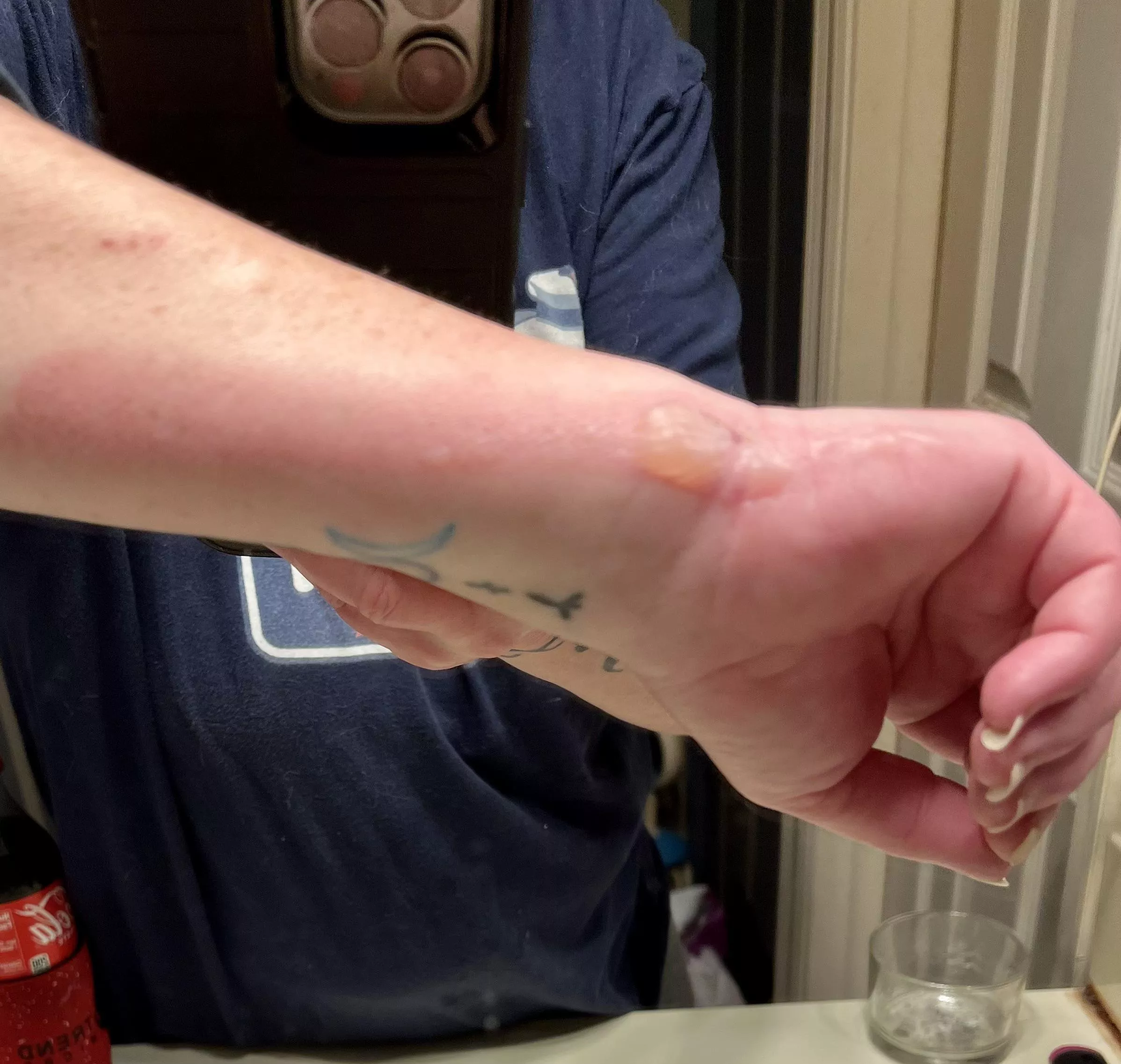 Forbidden Pop, Under Doctor Care