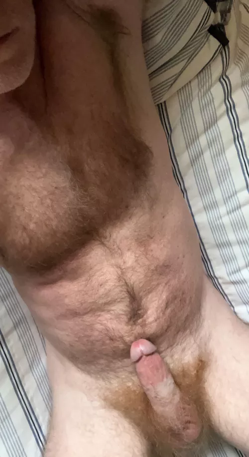 Tongue bath needed [44]