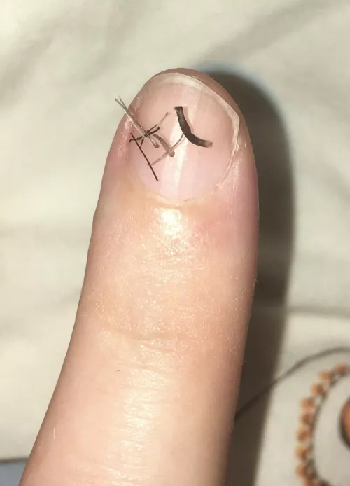 Abnormally thick beard hair. Normal sized ones are also included for reference.