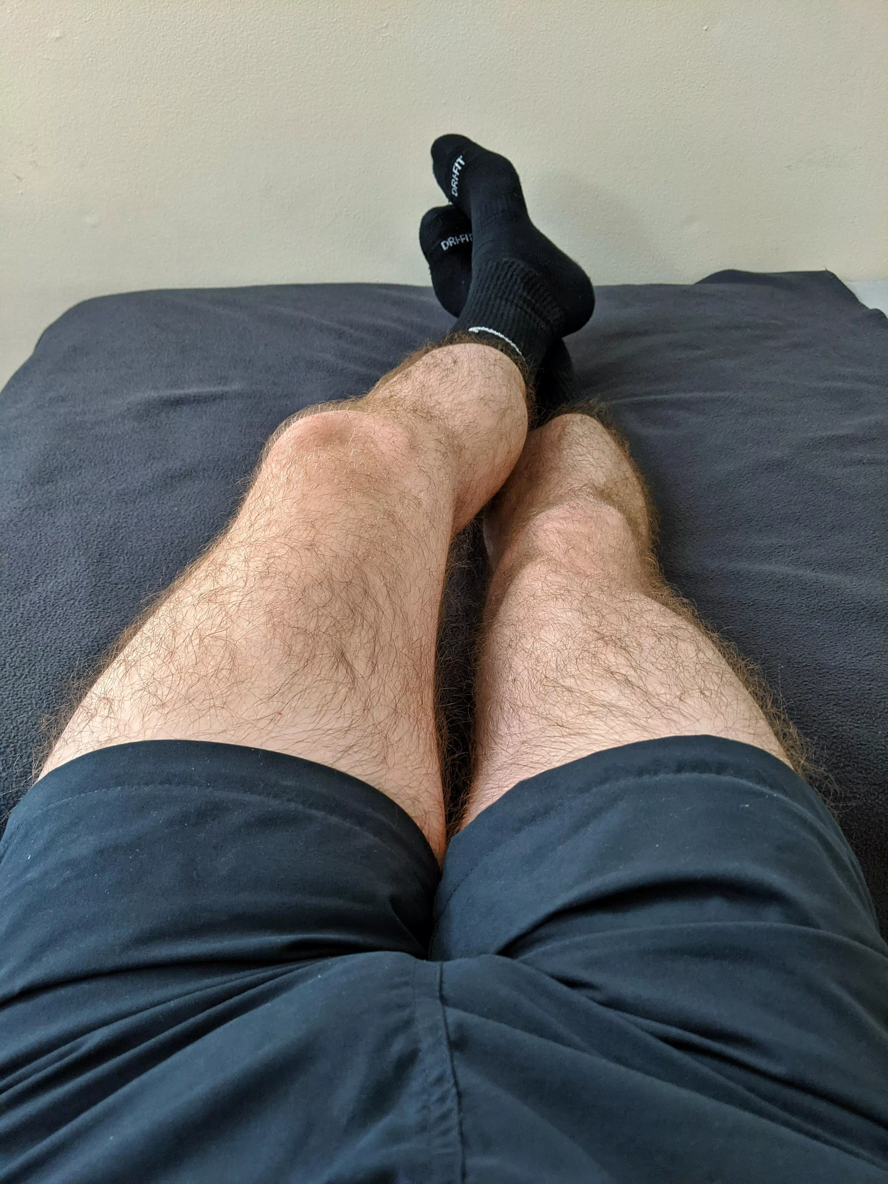 [26] you bros fans of hairy legs?