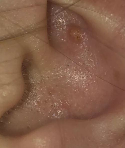 he won’t let me pop any of these beauties :(