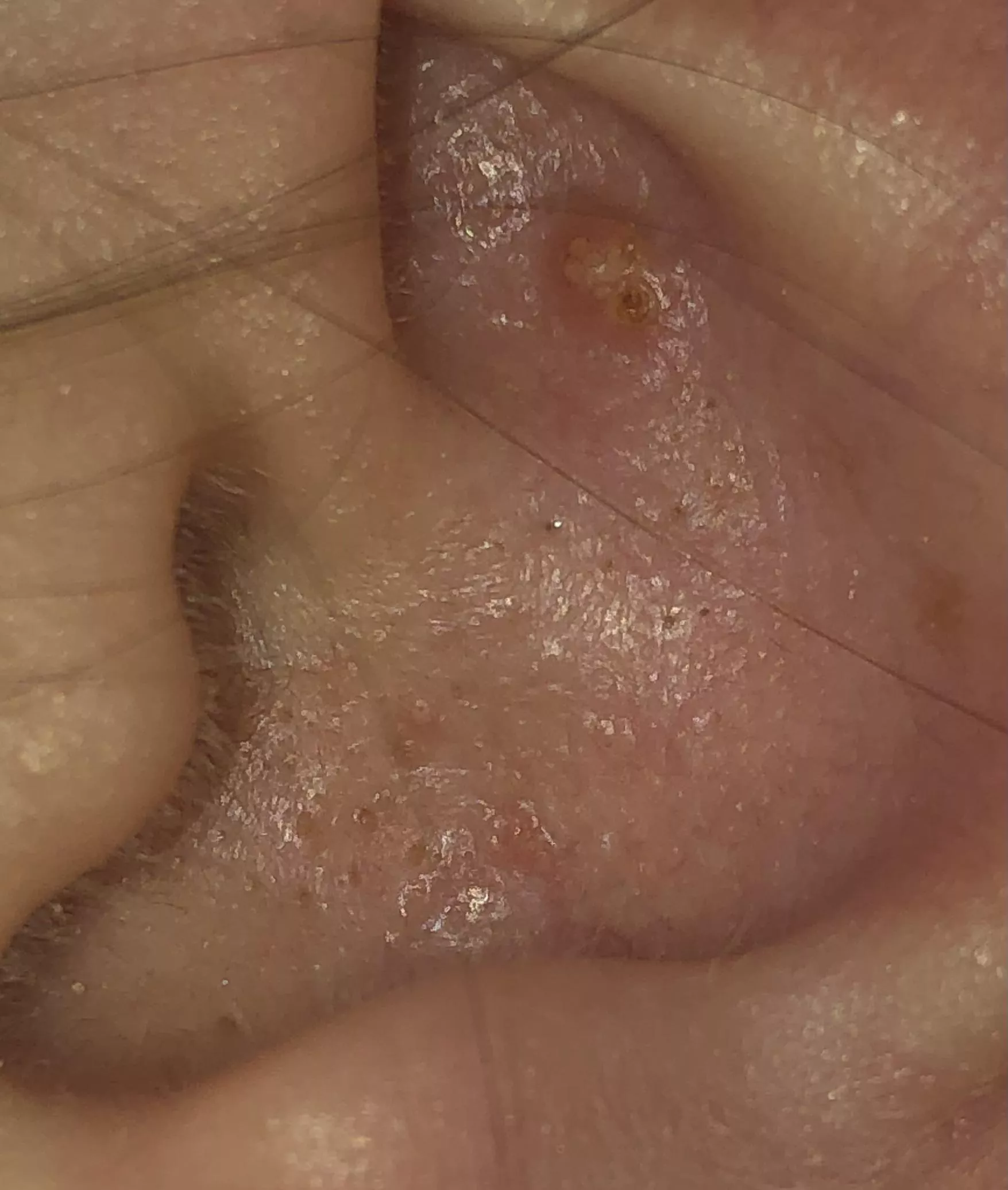 he won’t let me pop any of these beauties :(