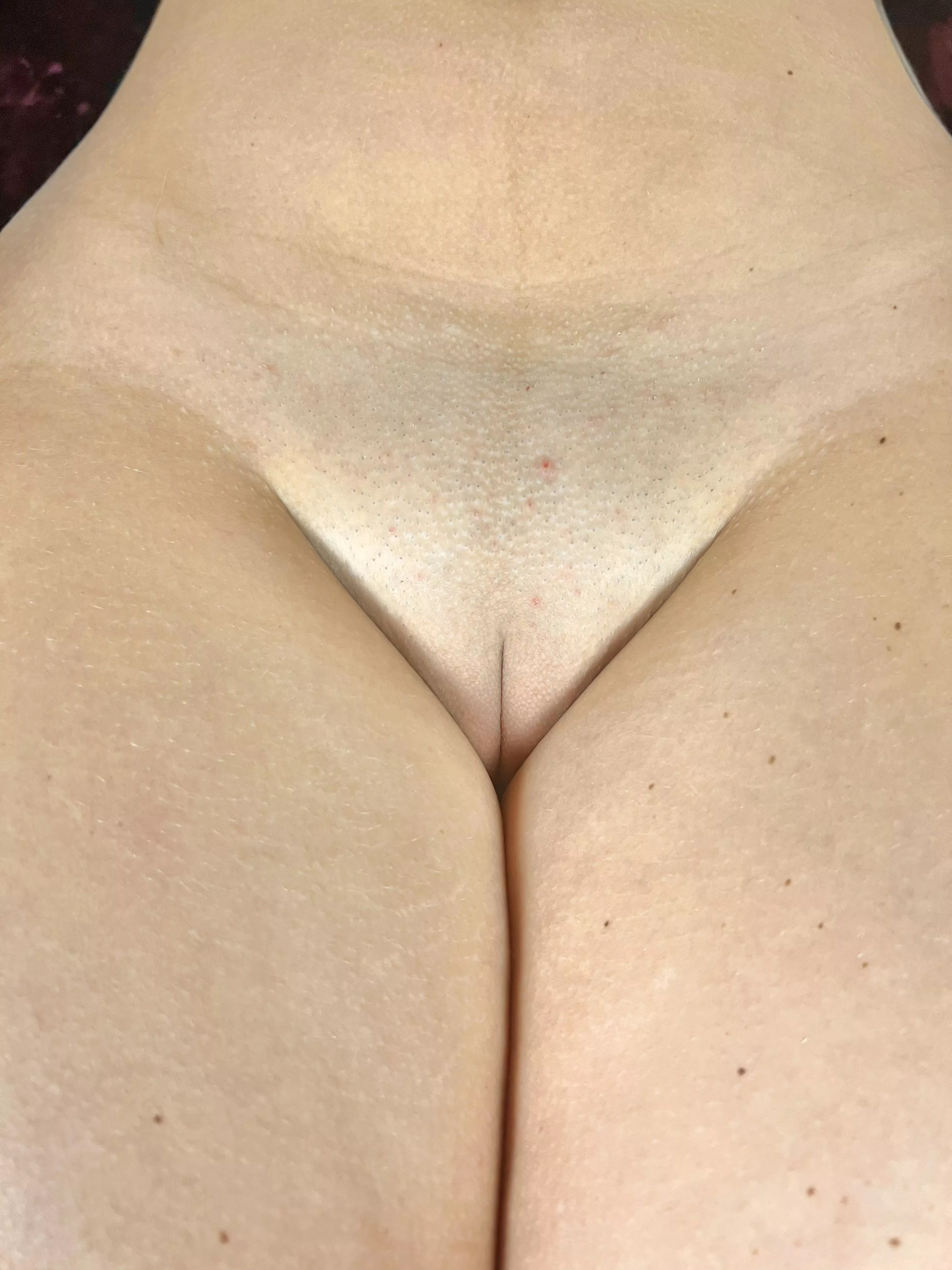 The Front View That You Were Asking For