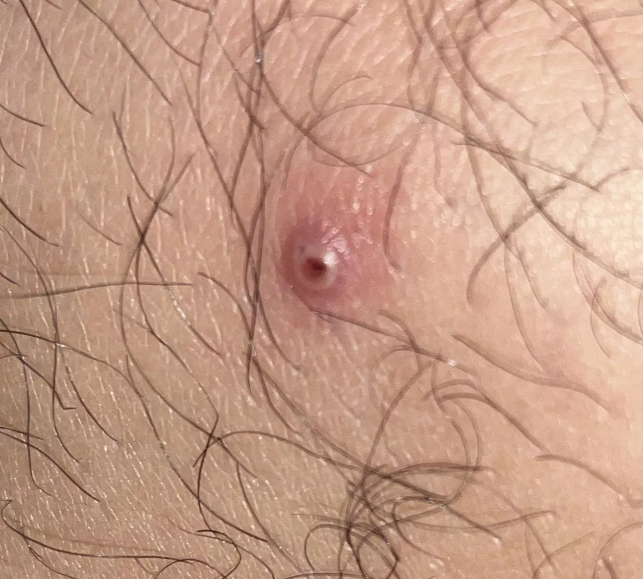 Tempted to pop, but not sure what it is. Advice?