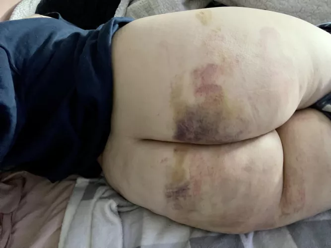 The morning after.. 🥰