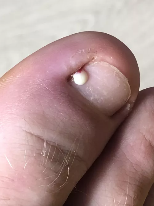 It popped super fast I didnt expect it