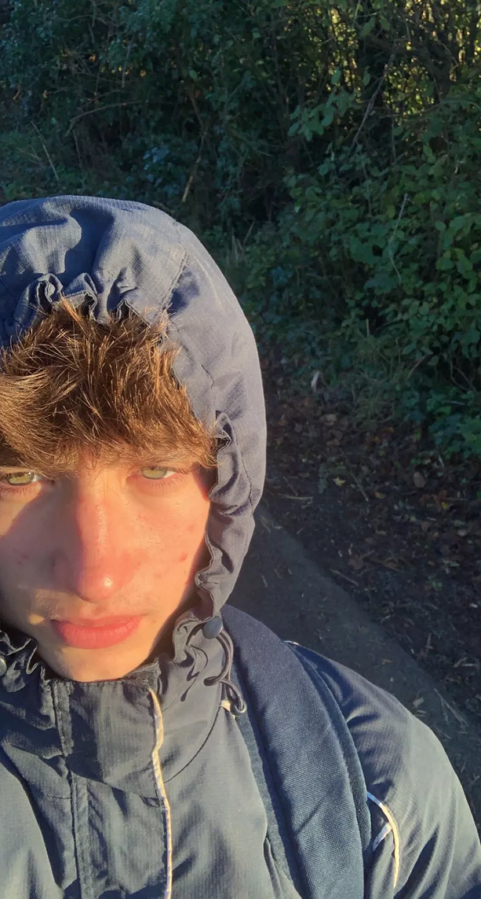 thoughts about my eyes?👀