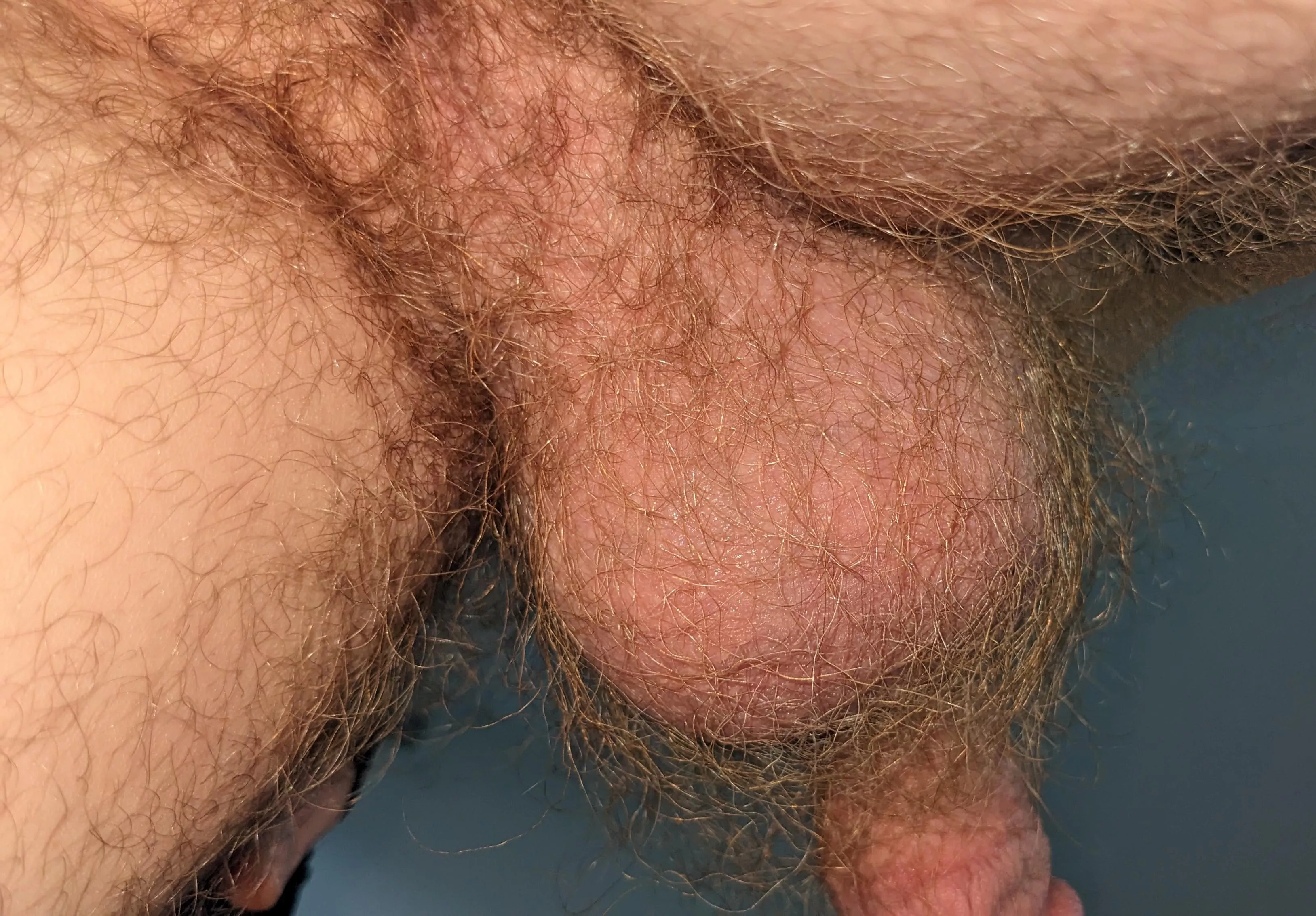Would you say my taint and balls qualify as insanely hairy?