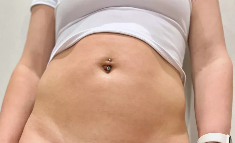 35F tummy in a white crop top :)