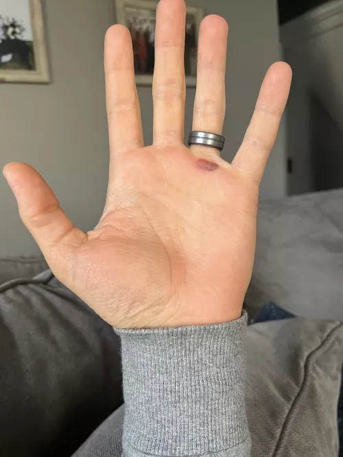 [forbidden pop] I can feel it pulse with every heartbeat