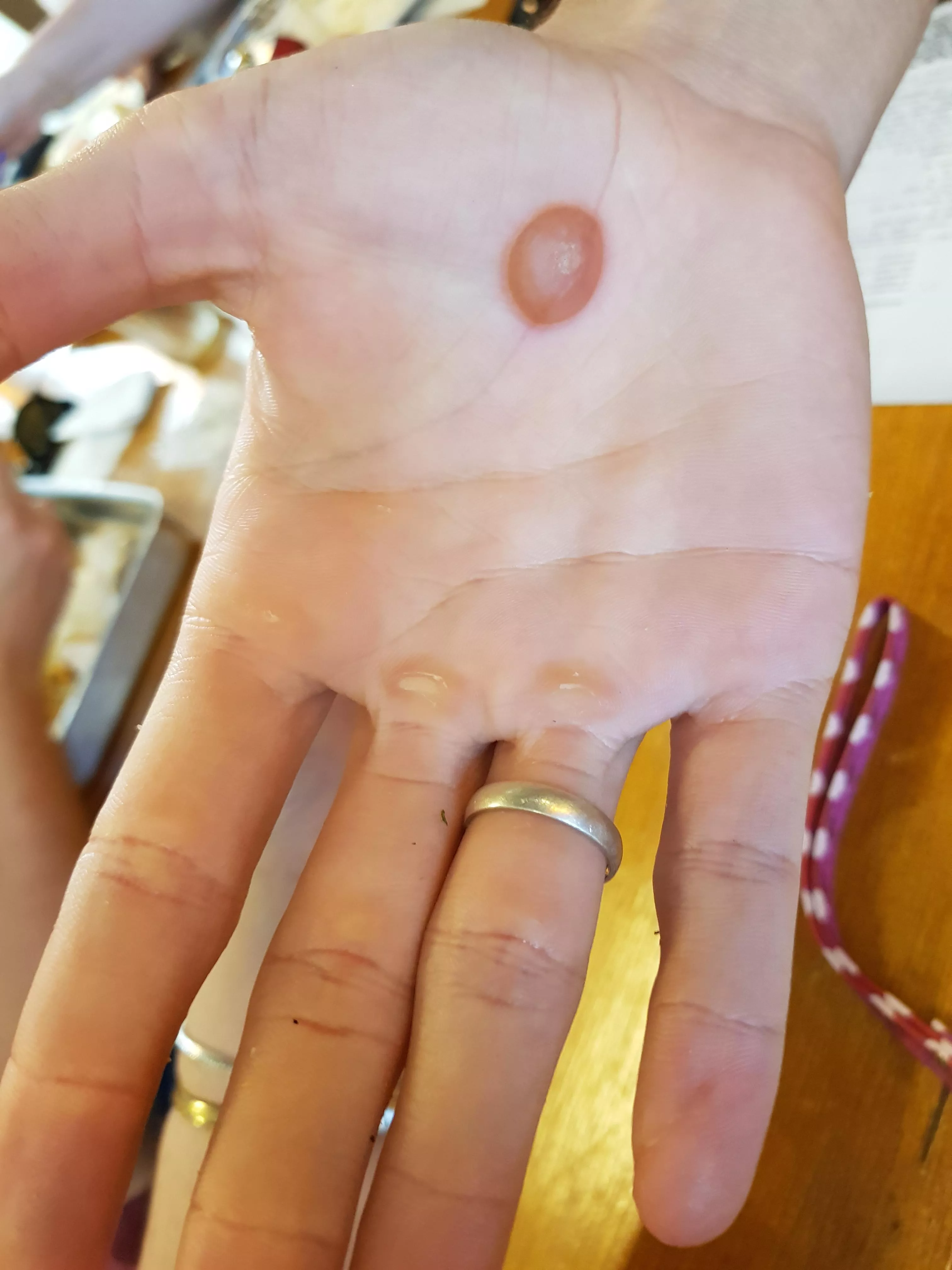 My coworker hand today...