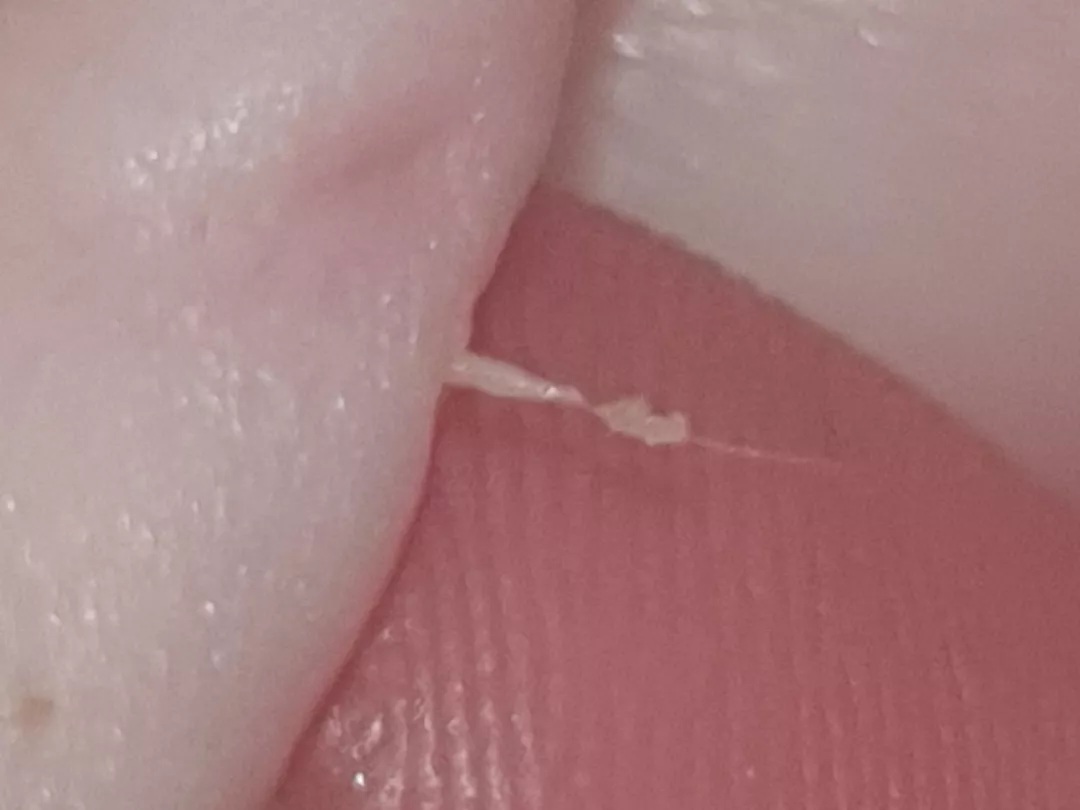 Sebum on a hair maybe?