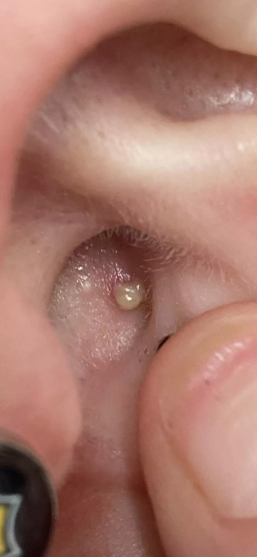 Inner Ear - felt something inside