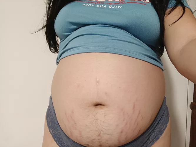 Stretch marks from stretching my belly 🤩
