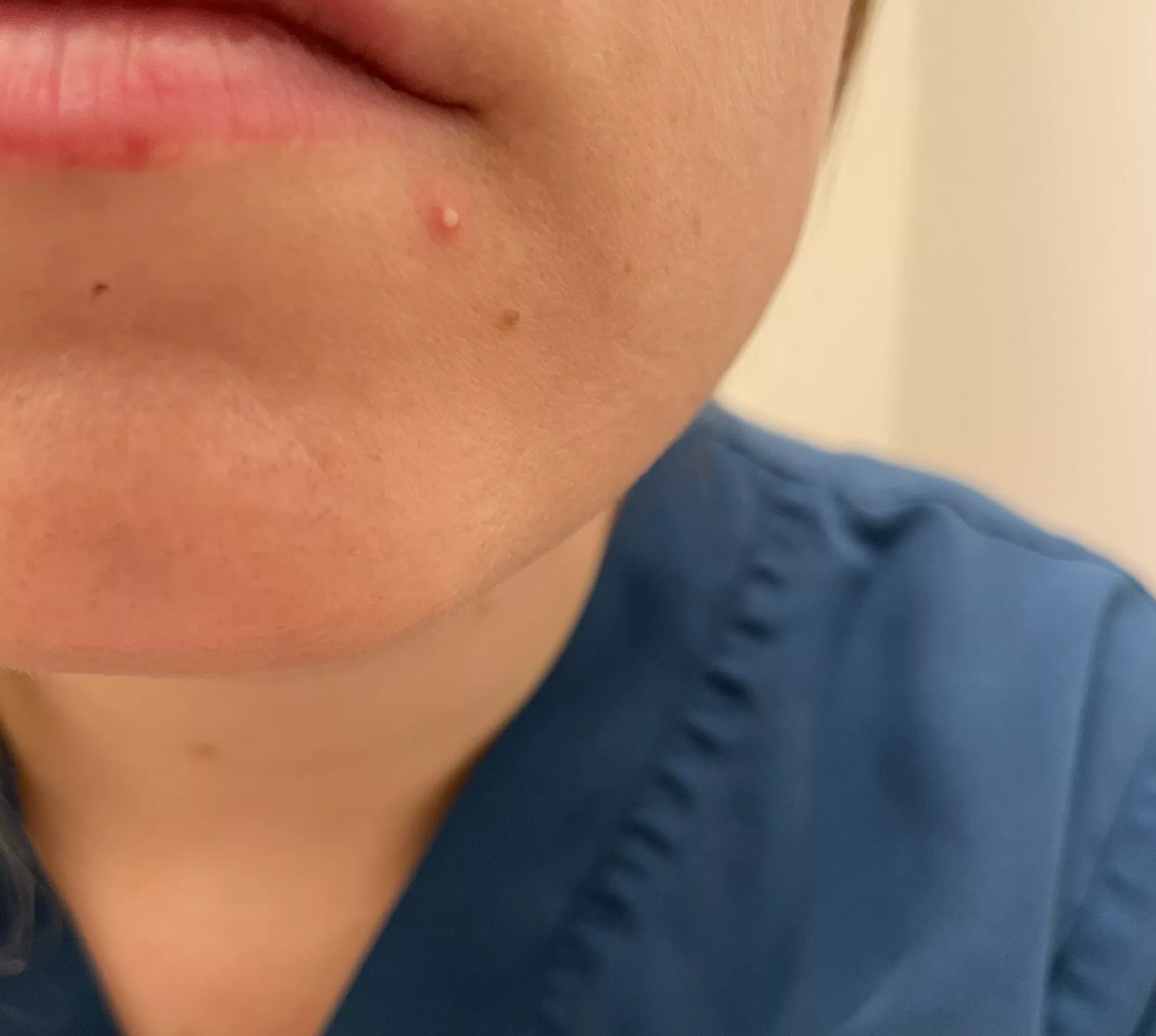 Why I don't mind still wearing a mask (pop later!)