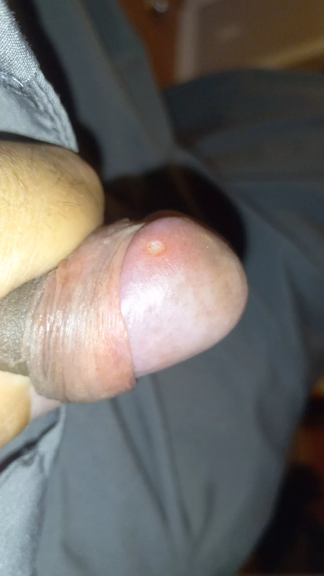 Can someone please help me figure out what this is haven't been sexually active in a couple months but have been maturbating alot an my hygiene cleaning up after hasn't been that good either idk if it's a std or what can someone please help Can someone please help me figure out what this is haven't been sexually active in a couple months but have been maturbating alot an my hygiene cleaning up after hasn't been that good either idk if it's a std or what can someone please help