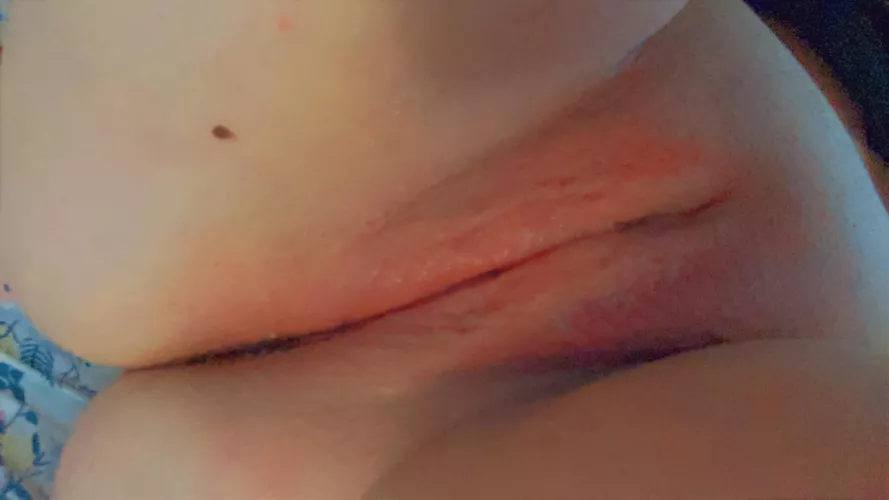 [35] Wanna see my freckle I’ve had all my life?