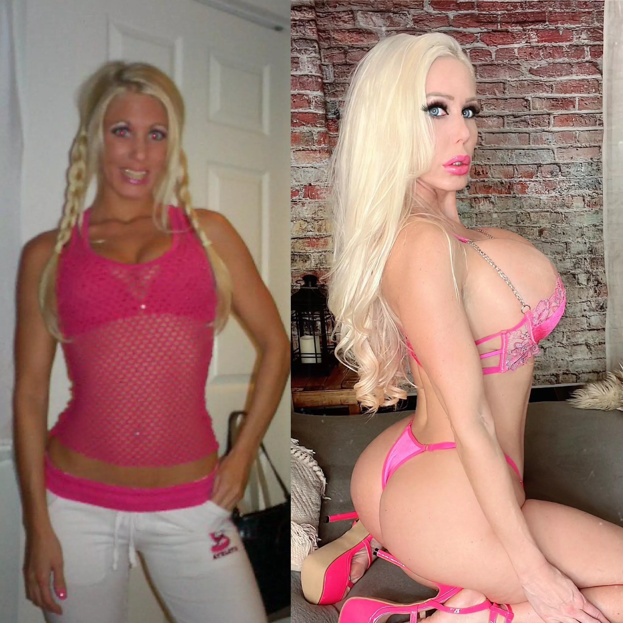 From b cup to DDD 1150cc and now healing from my new 1500cc. Plastic is fantastic