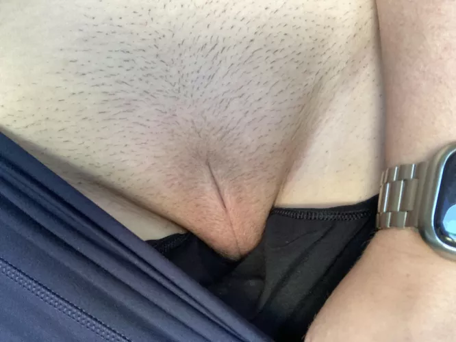 Starting laser hair removal. All of it will be gone! [F38]