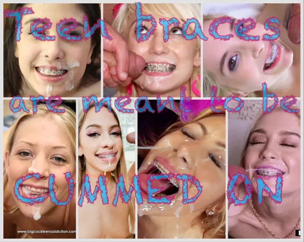 Thank god for bracefaced sluts