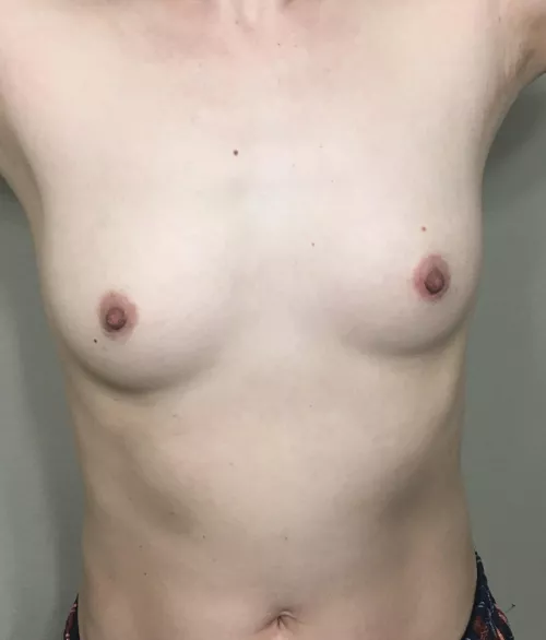 40F/125lbs/5’6” Asian mom feeling uncertain