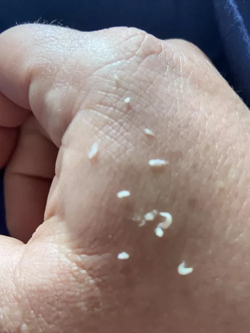 One of my nipples hurt and I squeezed so much out.