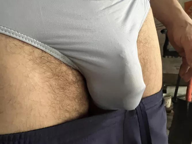 Soft bulge