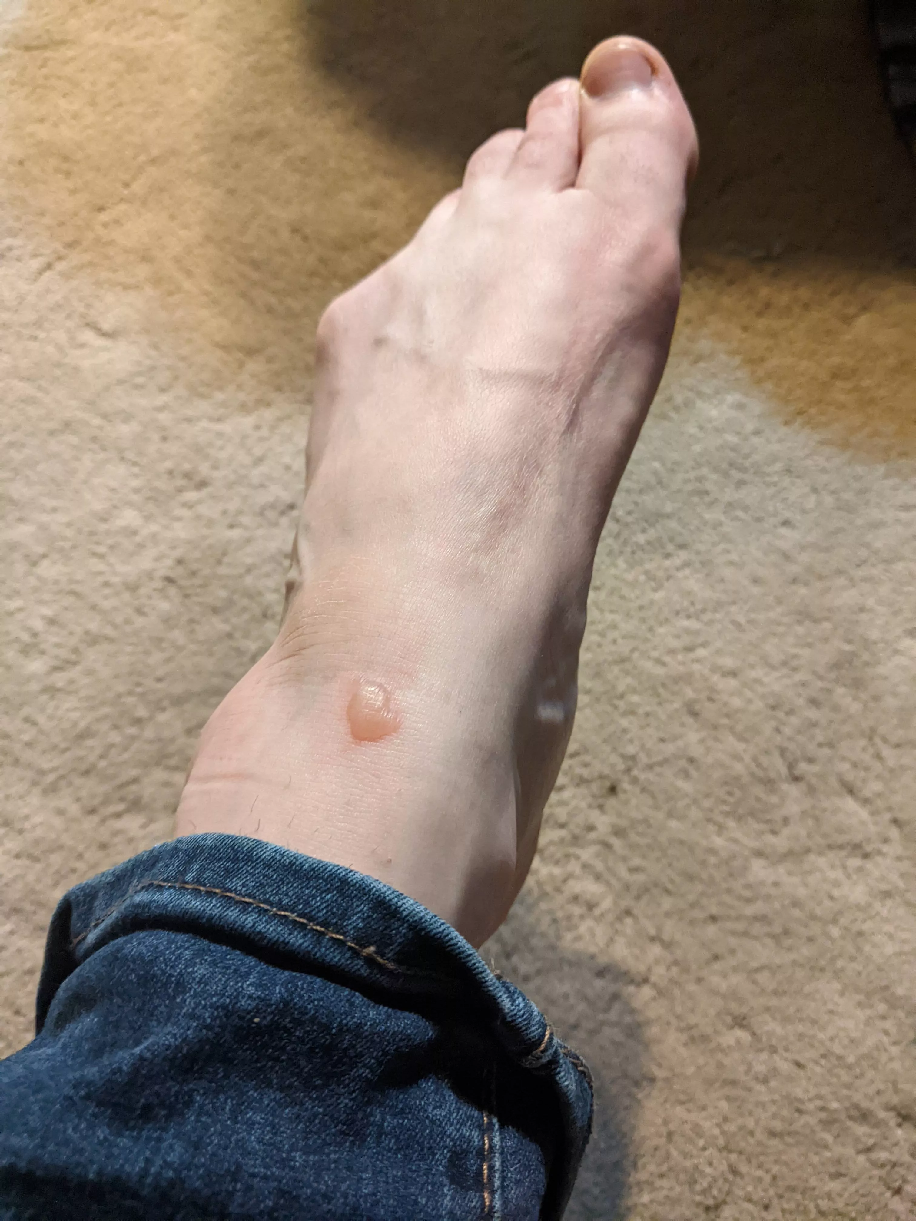 Forbidden pop: wore boots with new socks, and the two didn't agree...