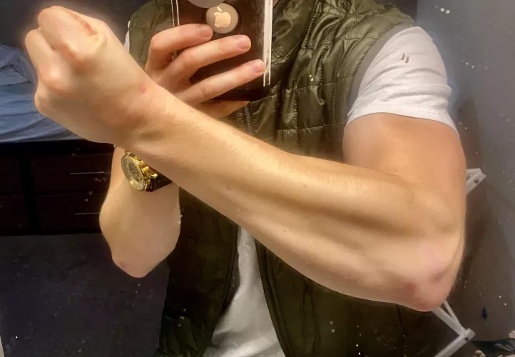 Post Oil Change Pump