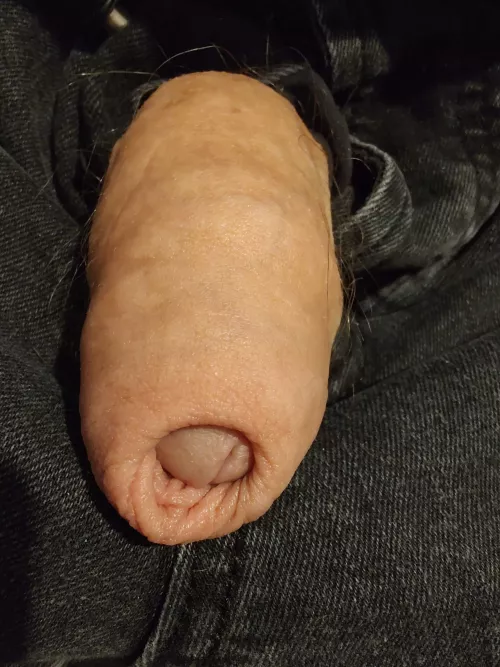 Head peeking out from under the foreskin