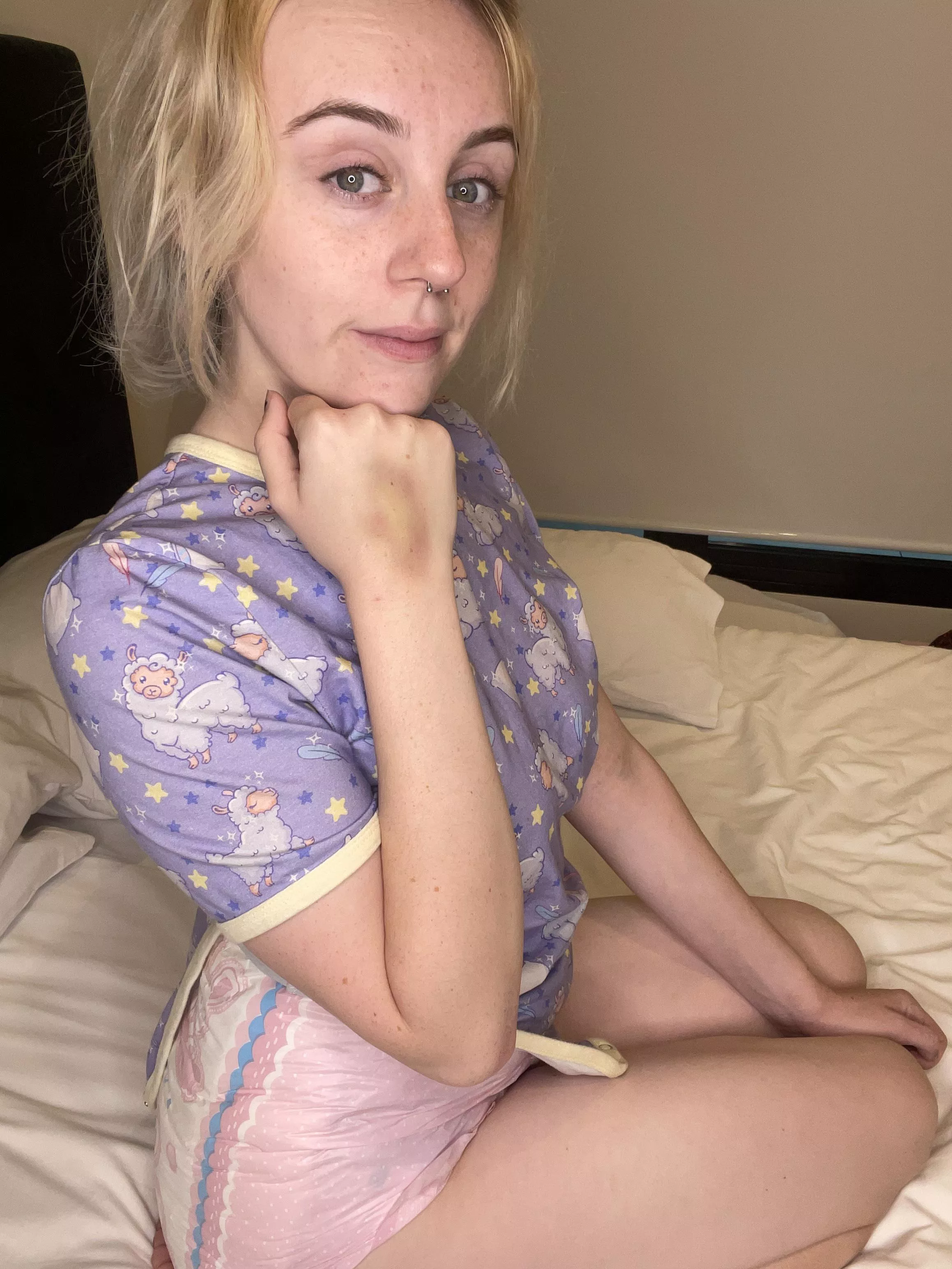 I have bruise 😭 maybe daddy can help me feel better? 🥺🥺💕