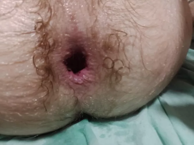 My friend bet $100 that I couldn't handle his penis. That was the result.