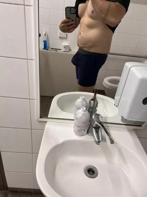 Can any body help with this bulge 🤷🏻‍♂️
