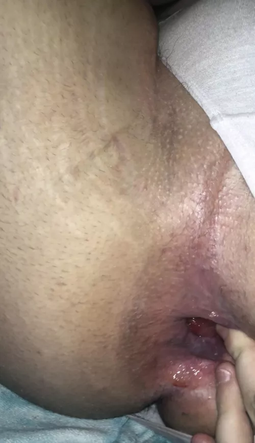 my loose, abused hole! [18][dms open]