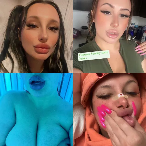 Someone on Twitter said my fake lips are ugly lol