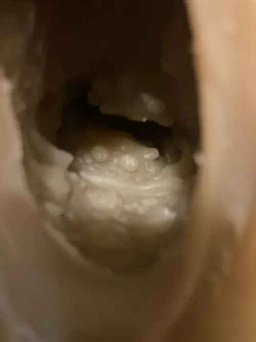 How to smooth out these vagina bumps? Can’t find any videos on a heating rod to the vagina/anal.