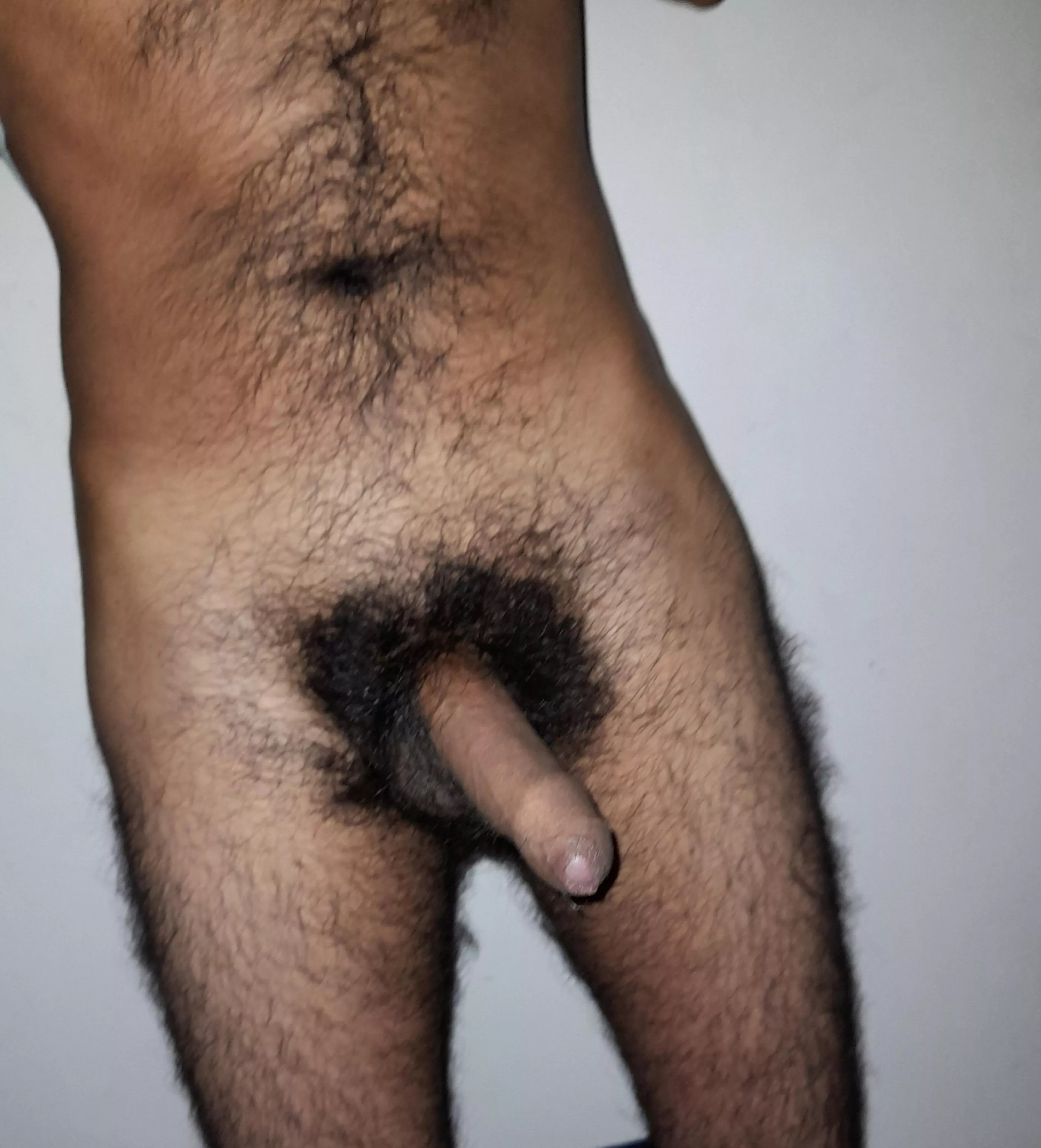 Very very heavily hairy