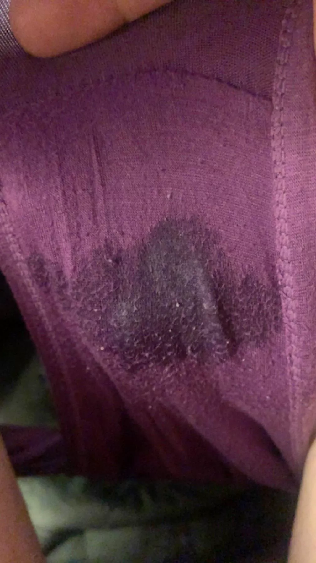 Woke up like this after fun last night..