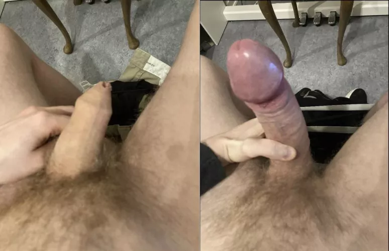 All skin stays on the body