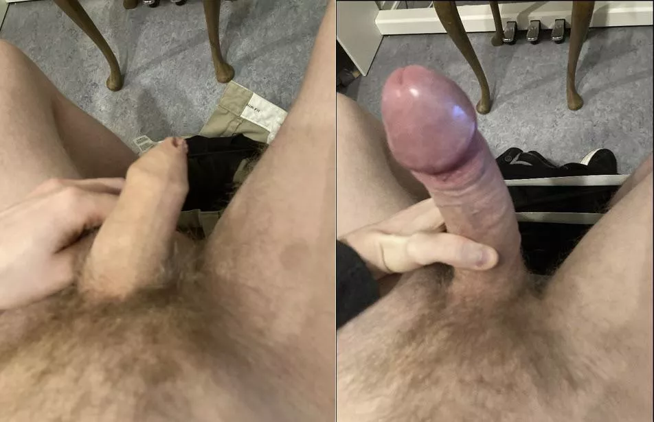 All skin stays on the body