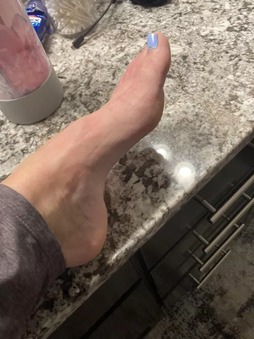 Are my arches too high?