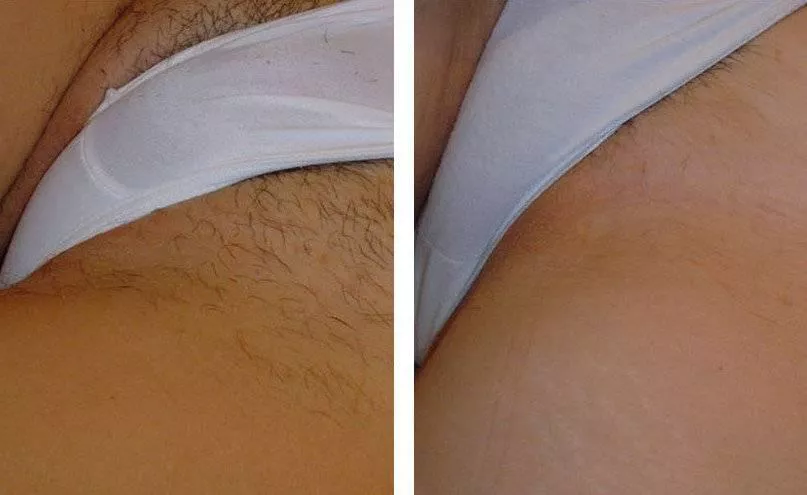 There’s a hairy prize under my panties. 😉