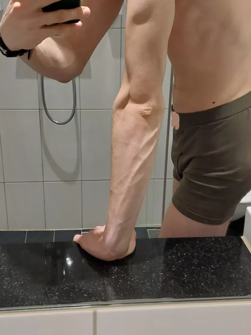 Find the missing thing in this pic