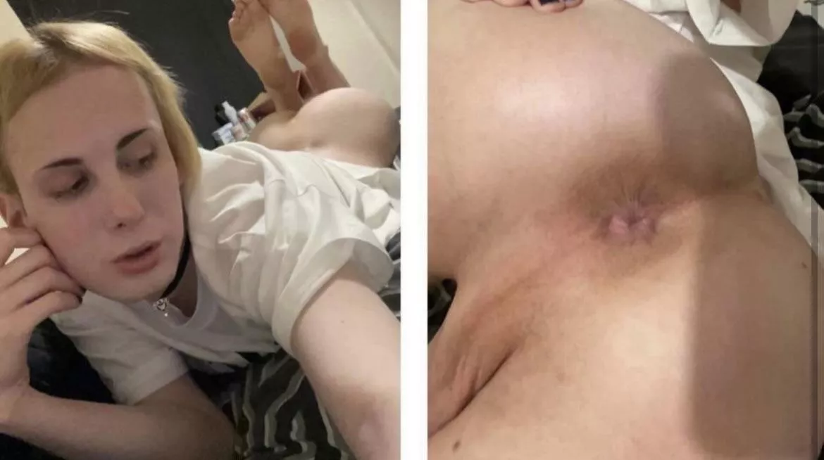 I’d love a nice filling 🥰